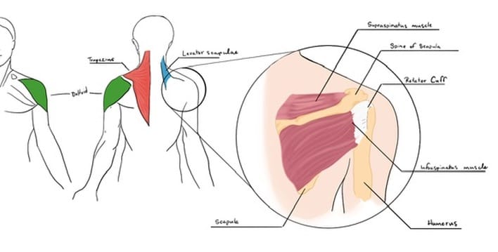 An illustration displaying the deltoid, trapezius, and levator scapulae muscles along with the scapula, humerus, supraspinatus, and infraspinatus muscles.